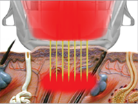 RF Emission